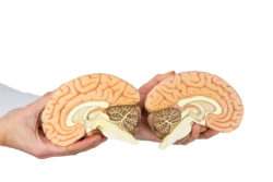 Symptoms of cerebellar atrophy can affect one's brain.
