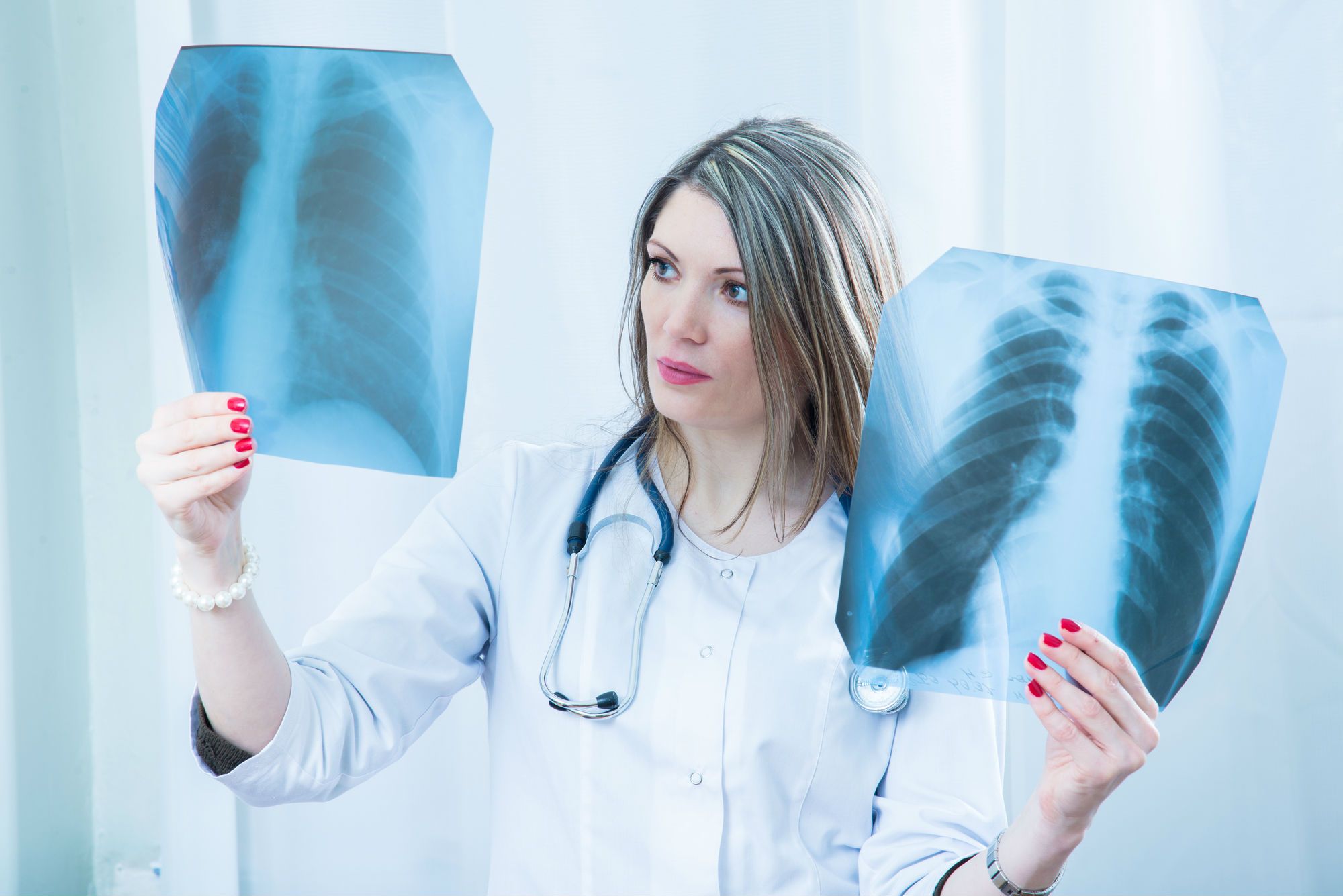 Determining if lung cancer is caused by asbestos