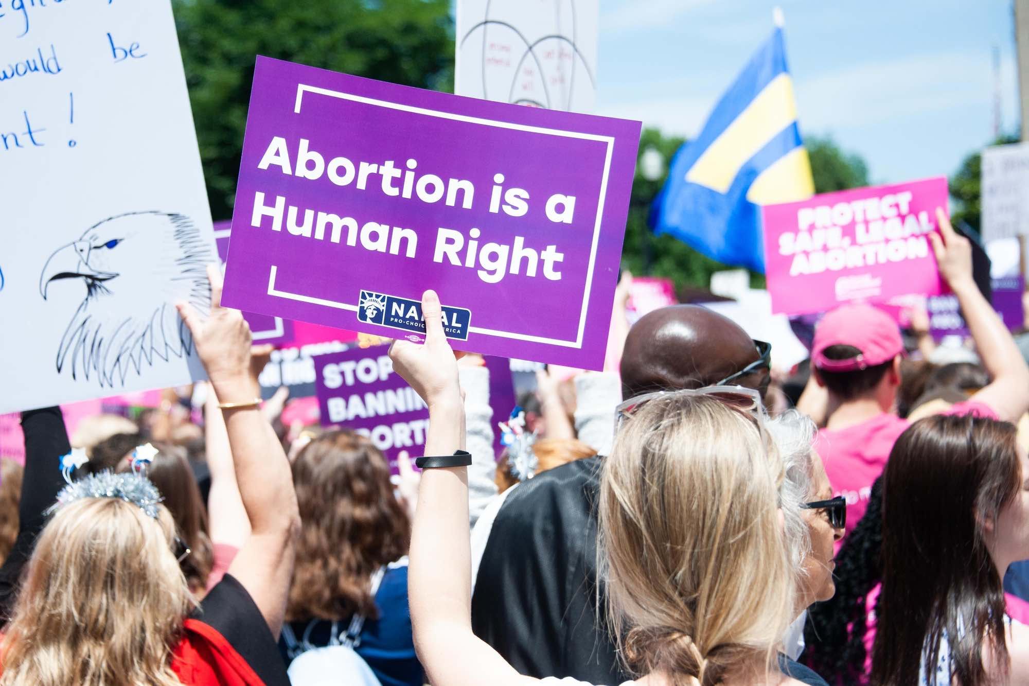 Abortion is a human right poster