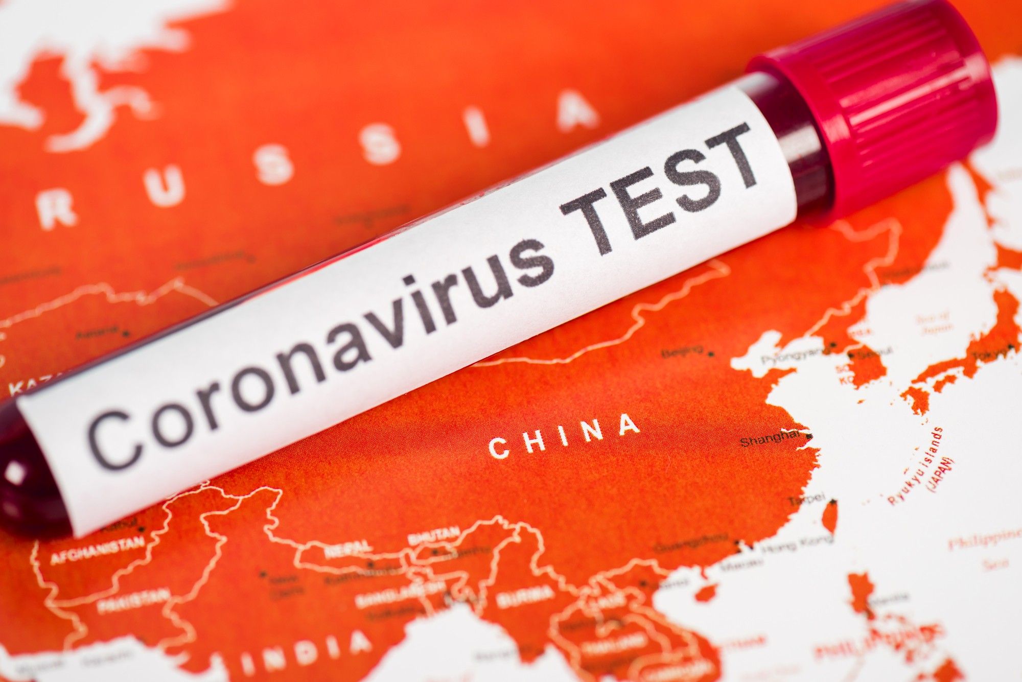 China has been accused of covering up the impact of coronavirus