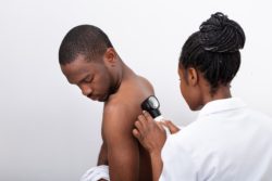 african man checking skin for melanoma