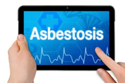 Asbestosis disease