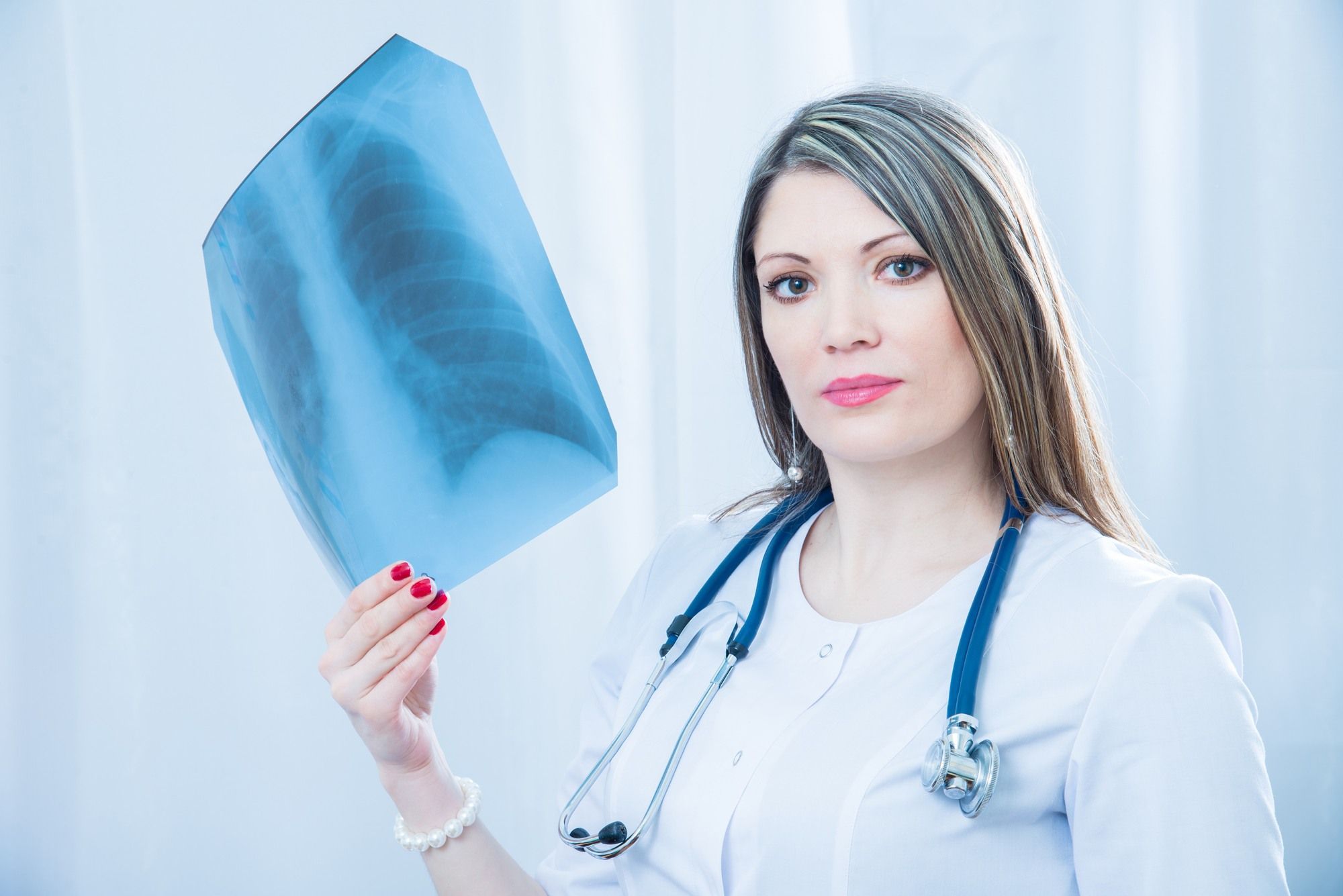 Female doctor holds lung X-ray film