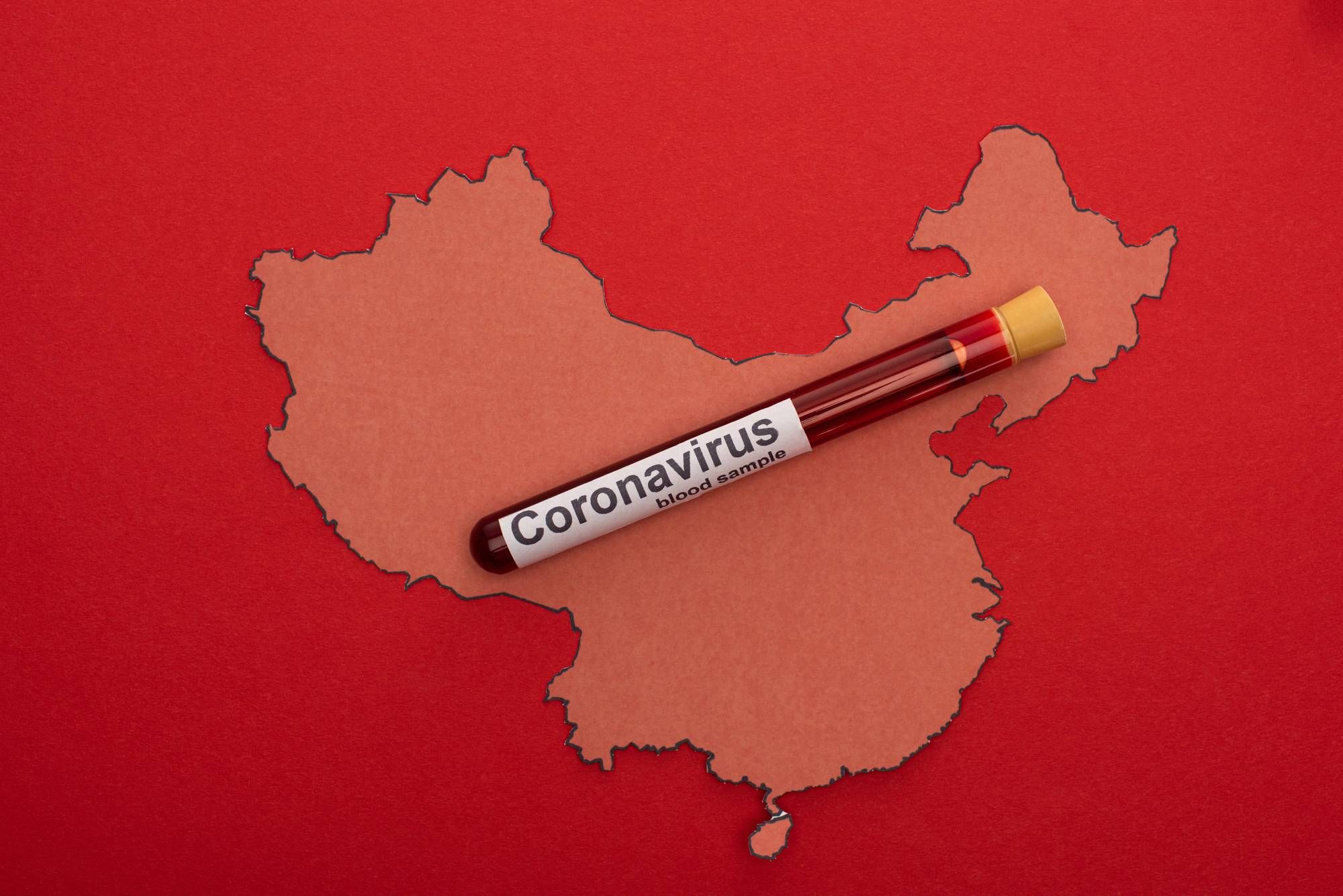 A new China policy bill would allow the country to be held liable in coronavirus outbreak lawsuits.