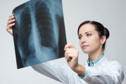 Female doctor examines lung X-ray