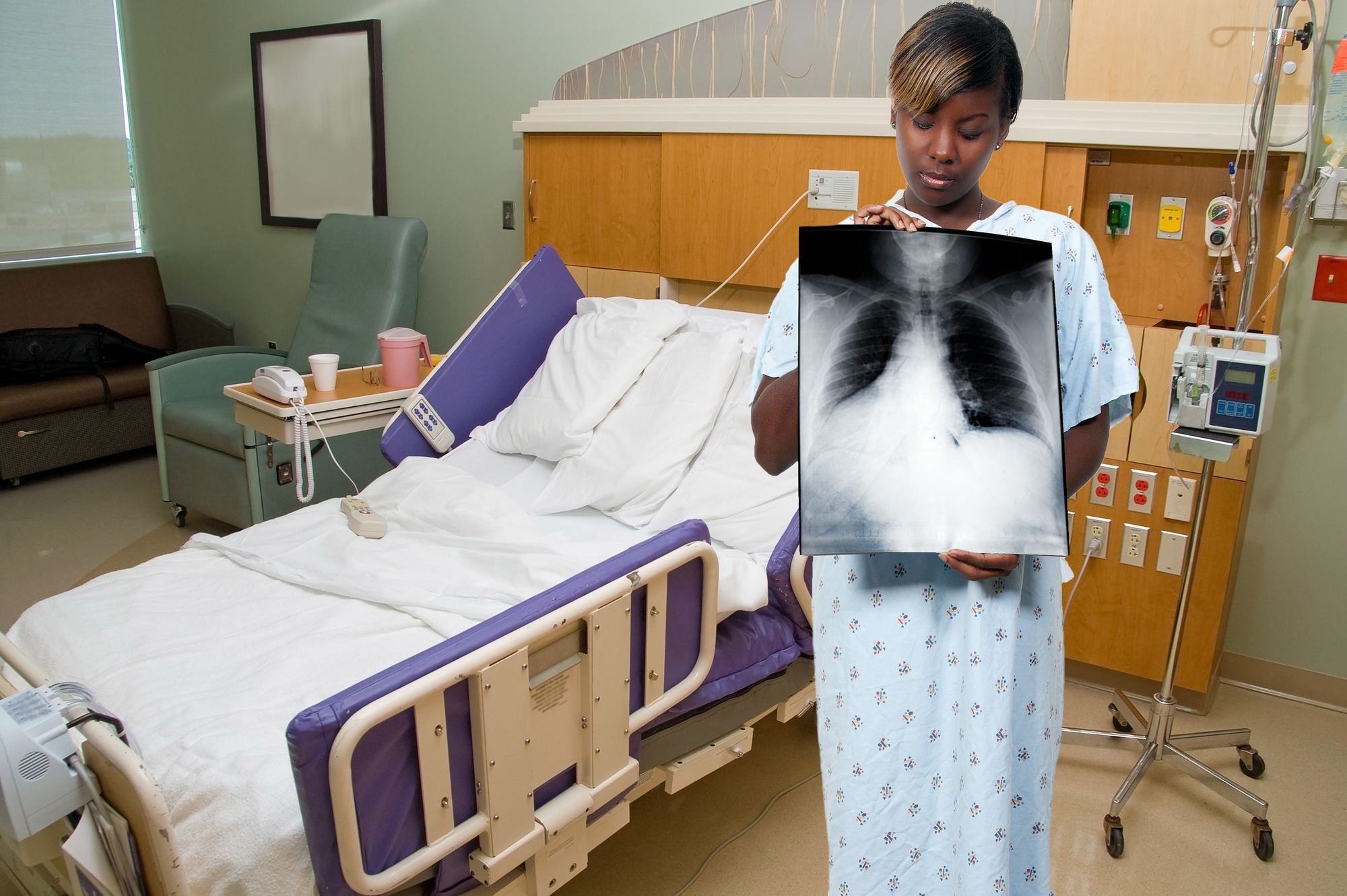 Female patient holds chest X-ray film