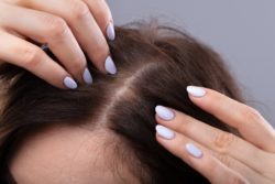 Hair loss may be one of the side effects of keratin.