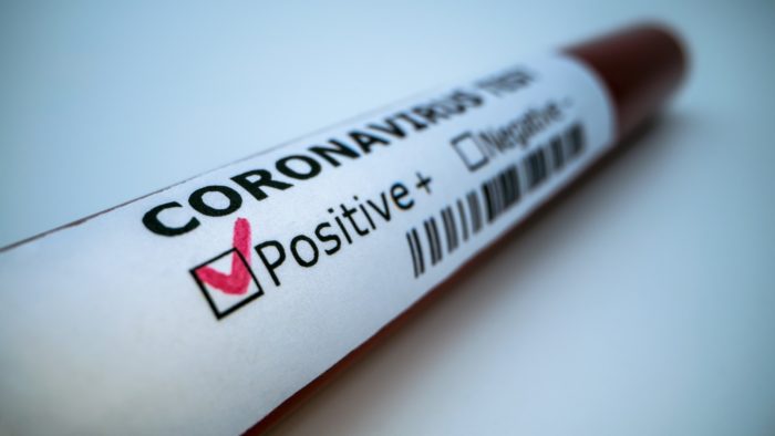 coronavirus positive test