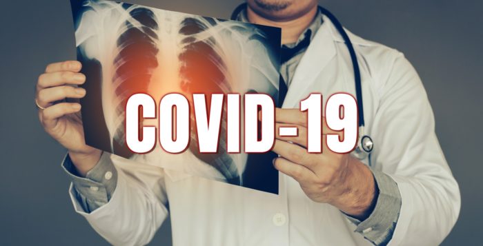 Doctor holding up covid-19 x-ray