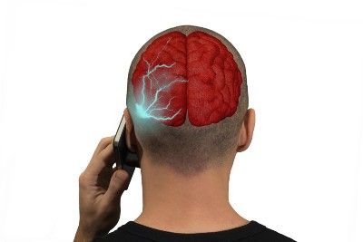 A graphic of radiation affecting the brain of a cellphone user - iPhone radiation