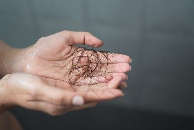A woman holds wet hair in her hands - hair loss