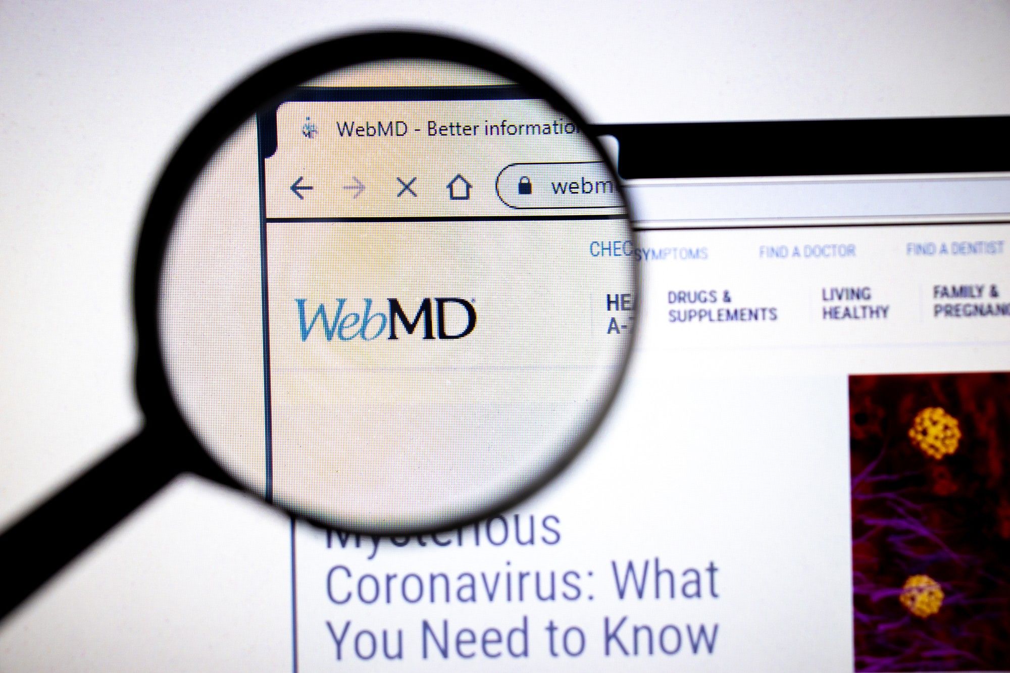 A class action lawsuit alleges the WebMD records visitors to their website.