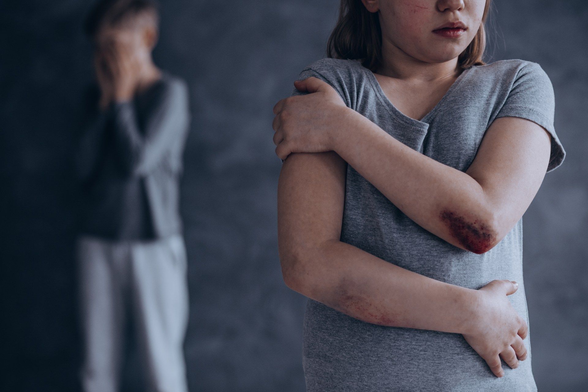 A young girl holds her arm right arm with her left arm, with bruising and cuts on her arms and face, as a young boy stands in the background - Child and Parent Resource Institute
