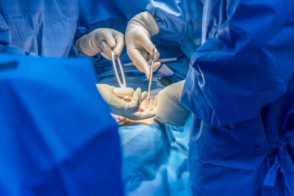 Close up of surgeons performing an operation, PerFix Plug, representing the hernia mesh injuries lawsuit.